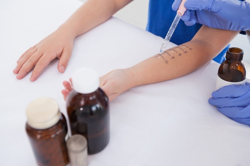 Doctor performing an allergy test on a young patient's arm.