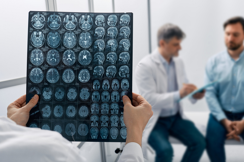 Male patient consulting with a neurologist while another physician is looking at MRI brain scans.